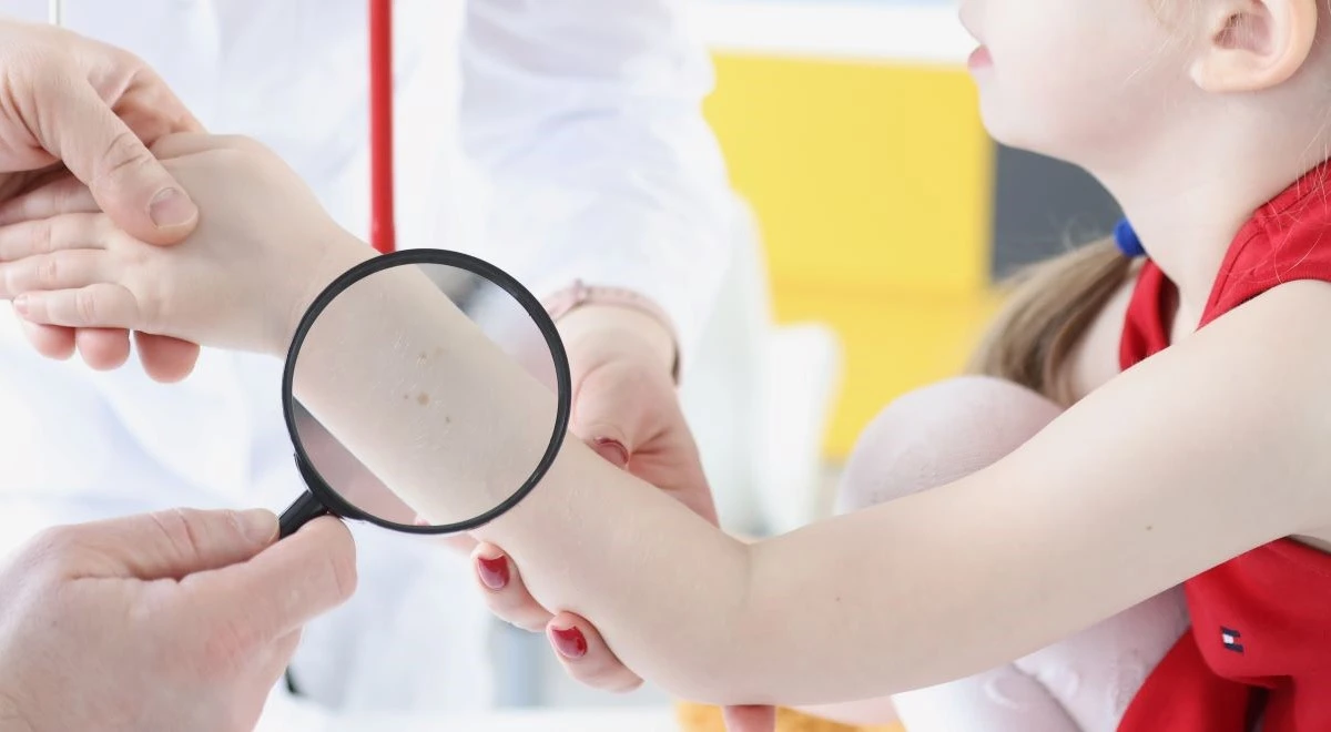 Pete maronii pe piele la copii: cauze și metode de diagnosticare